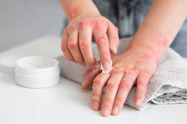 Аллергия на крем для лица: симптомы и лечение