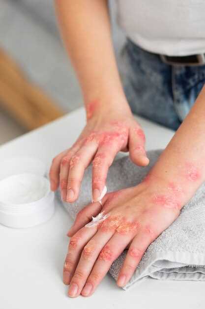 Аллергия на коже: сыпь, фото, лечение