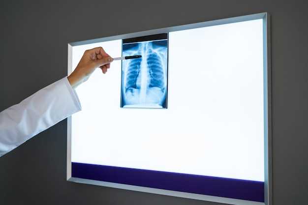 Важность правильной подготовки к рентгену грудной клетки